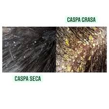 caspa