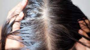 ¿Cómo prevenir la caída del cabello?