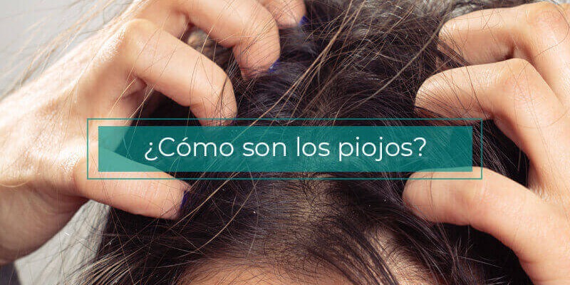 ¿Cómo son los piojos? y ¿Cómo eliminarlos?