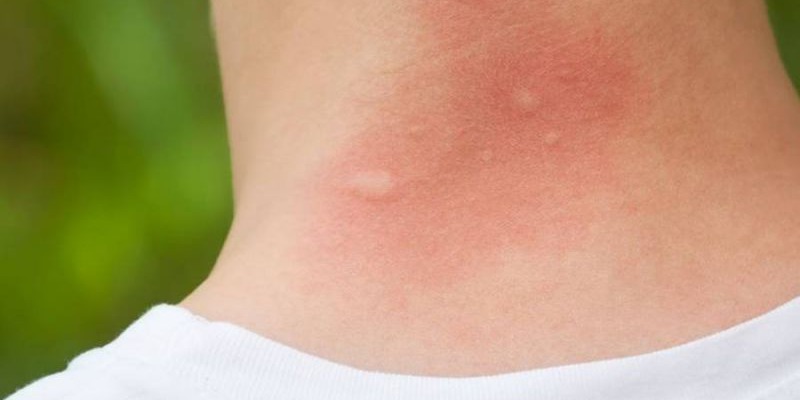 ¡S.O.S Mosquitos!