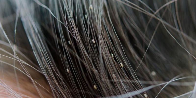 RECOMENDACIONES: VUELTA AL COLE SIN PIOJOS 