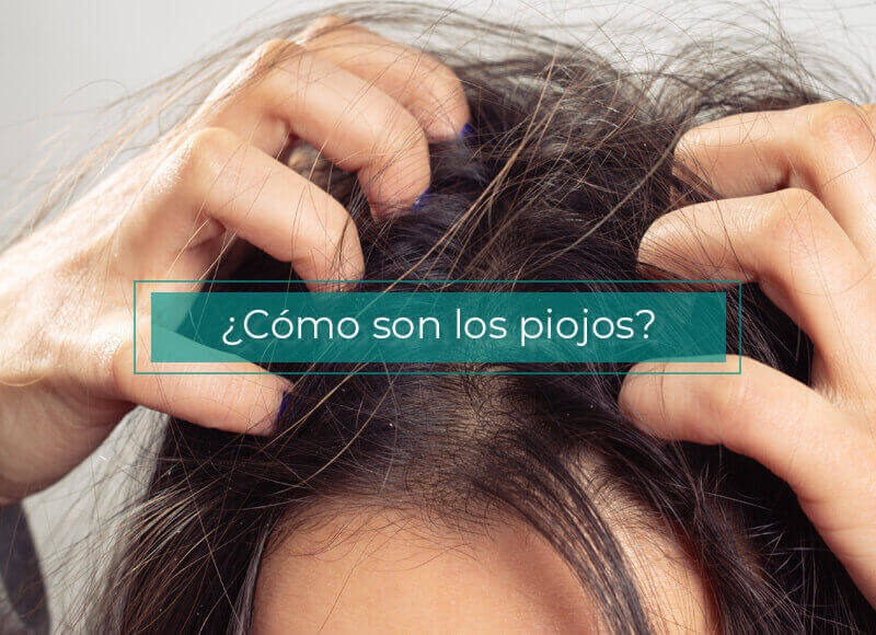 ¿Cómo son los piojos? y ¿Cómo eliminarlos?
